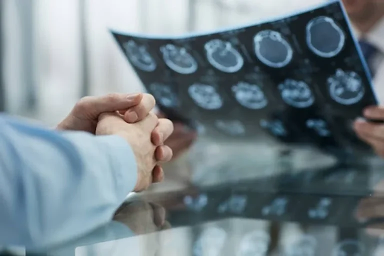 Why Brain Injury Cases in NYC Require More Than Basic Evidence