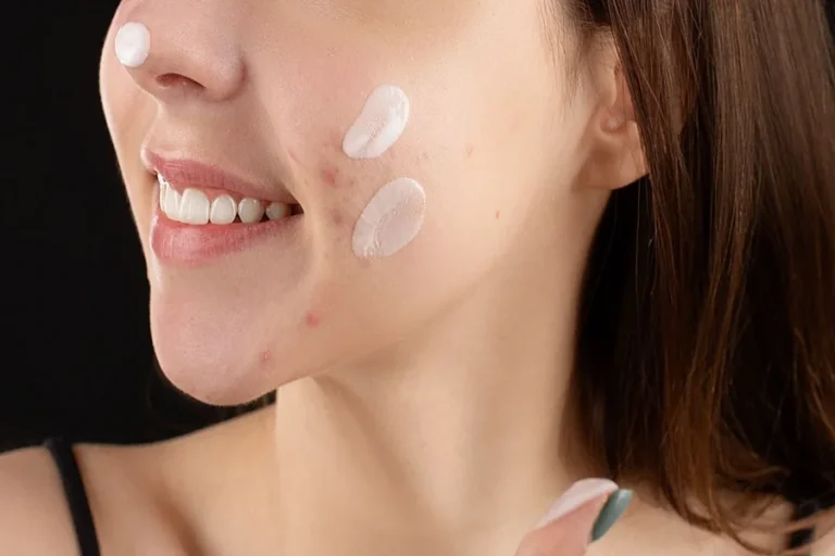 Niacinamide Gel