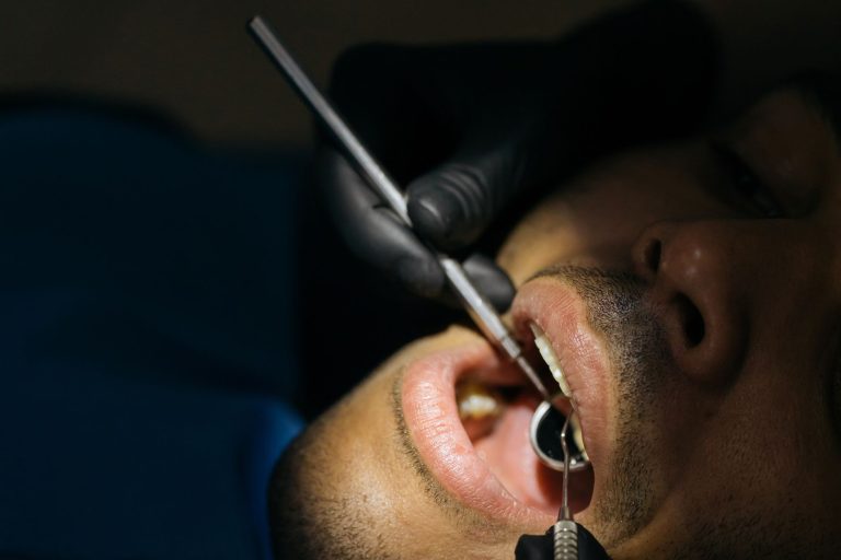Dry Mouth and Oral Health: Causes, Risks, and Treatment Options